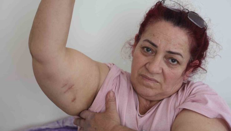 Köpeklerin saldırısına uğrayan kadın: “Ben o an öldüğümü sandım”