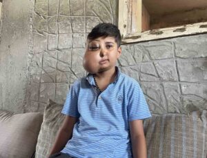 İki farklı yüzü var gibi görünen çocuğun tek isteği iyileşip gülmek