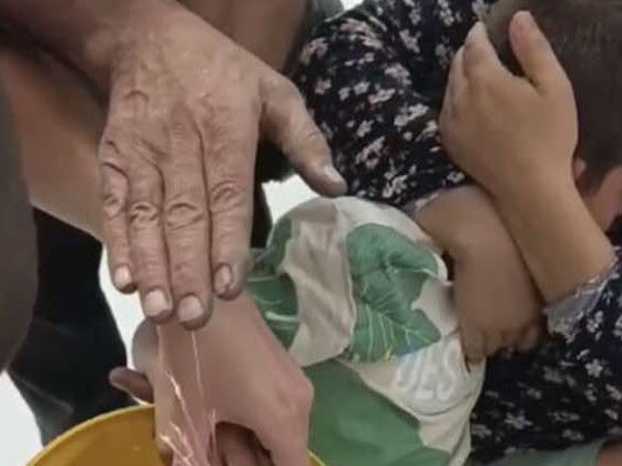 Parmağını metal eşyaya sıkıştıran çocuğun imdadına itfaiye yetişti