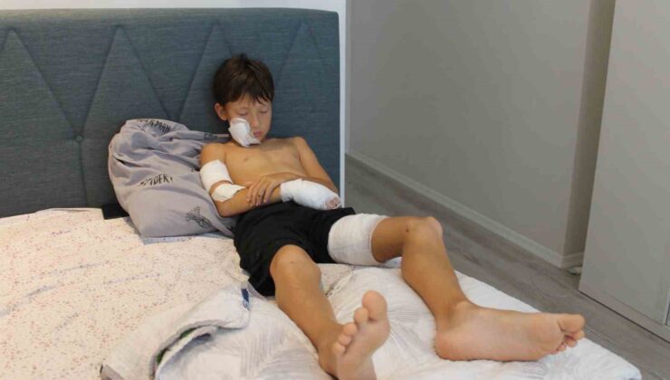 Taş attığı köpek zinciri kırarak dehşeti yaşattı