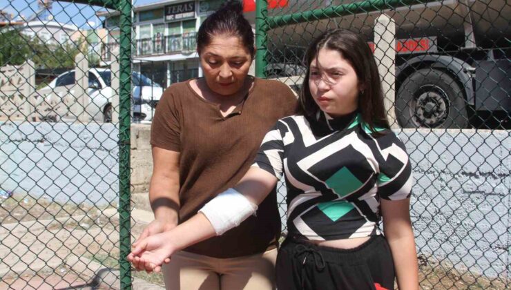 Basketbol oynarken kolu tele takılan küçük kız kanlar içinde kaldı