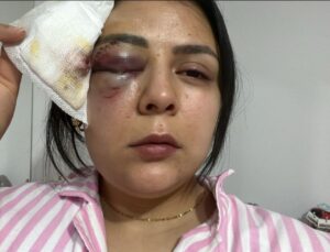 Yürürken saldırıya uğrayan genç kız konuştu: “Psikolojim altüst oldu”
