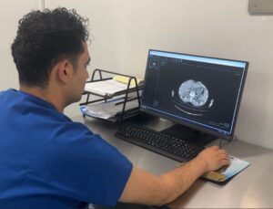 Osmaniye’de ilk kez kapalı ameliyatla böbrek tümörü başarıyla alındı